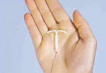 Можливі наслідки використання внутрішньоматкової спіралі для контрацепції Які болі при введенні ВМС
